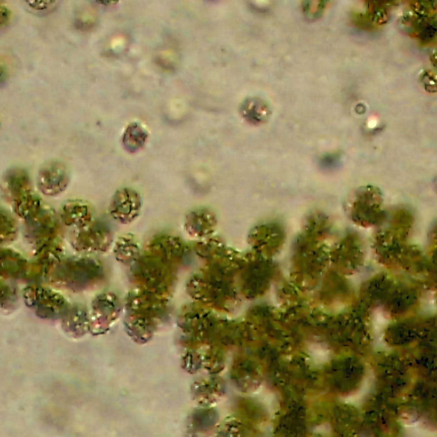 Image of Microcystis