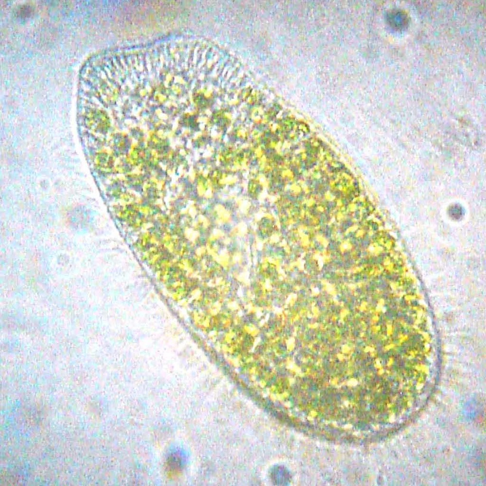   Parmecium bursaria  (Bob Blaylock, en.wikipedia.org). 