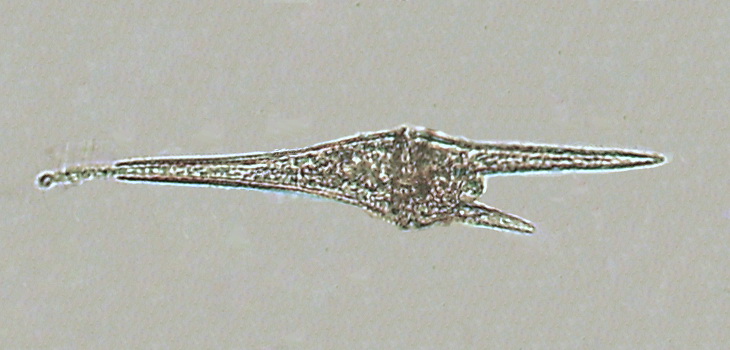  Ceratium furca, a dinoflagellate. By Minami Himemiya - Own work, CC BY-SA 3.0, https://commons.wikimedia.org/w/index.php?curid=4975413 